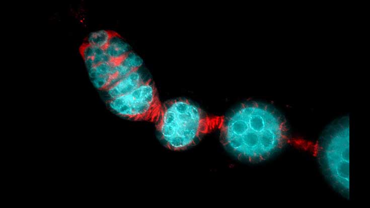 Image of the fruit fly ovary. Photo: Dr Elaine Dunleavy